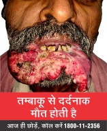 Description: cropped Tobacco Causes Painful Death-English 16 March_1
